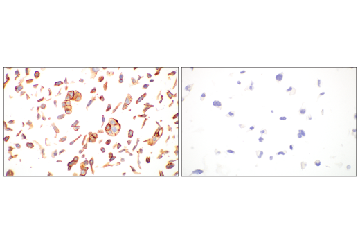 Immunohistochemistry Image 8: Integrin beta6 (E4M9P) Rabbit Monoclonal Antibody