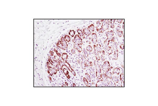 Immunohistochemistry Image 1: TrkA (14G6) Rabbit Monoclonal Antibody