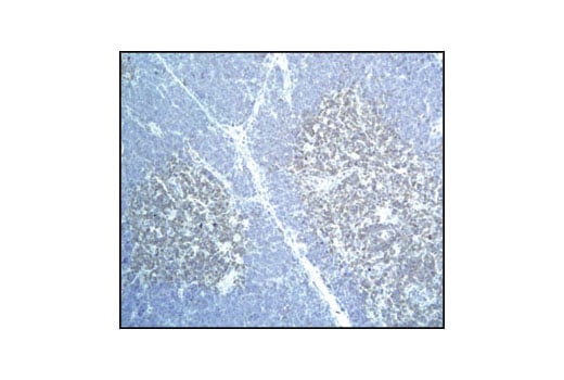 Immunohistochemistry Image 1: DRAK2 (33D7) Rabbit Monoclonal Antibody