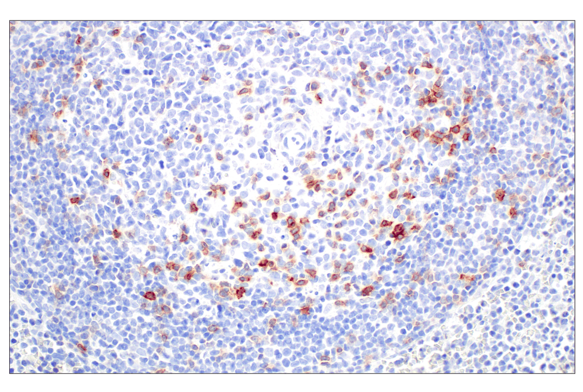 Immunohistochemistry Image 5: ICOS (D1K2T<sup>™</sup>) Rabbit Monoclonal Antibody