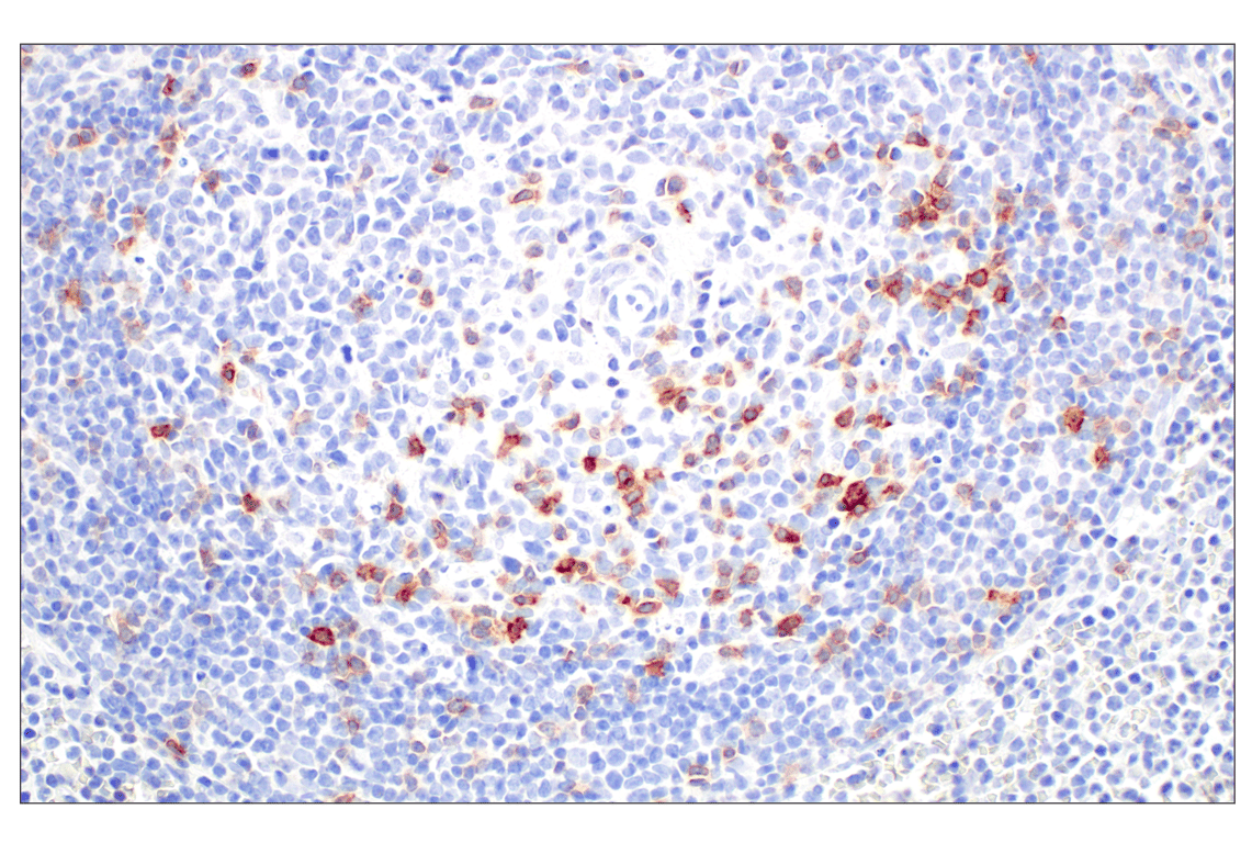 Immunohistochemistry Image 5: ICOS (D1K2T<sup>™</sup>) Rabbit mAb