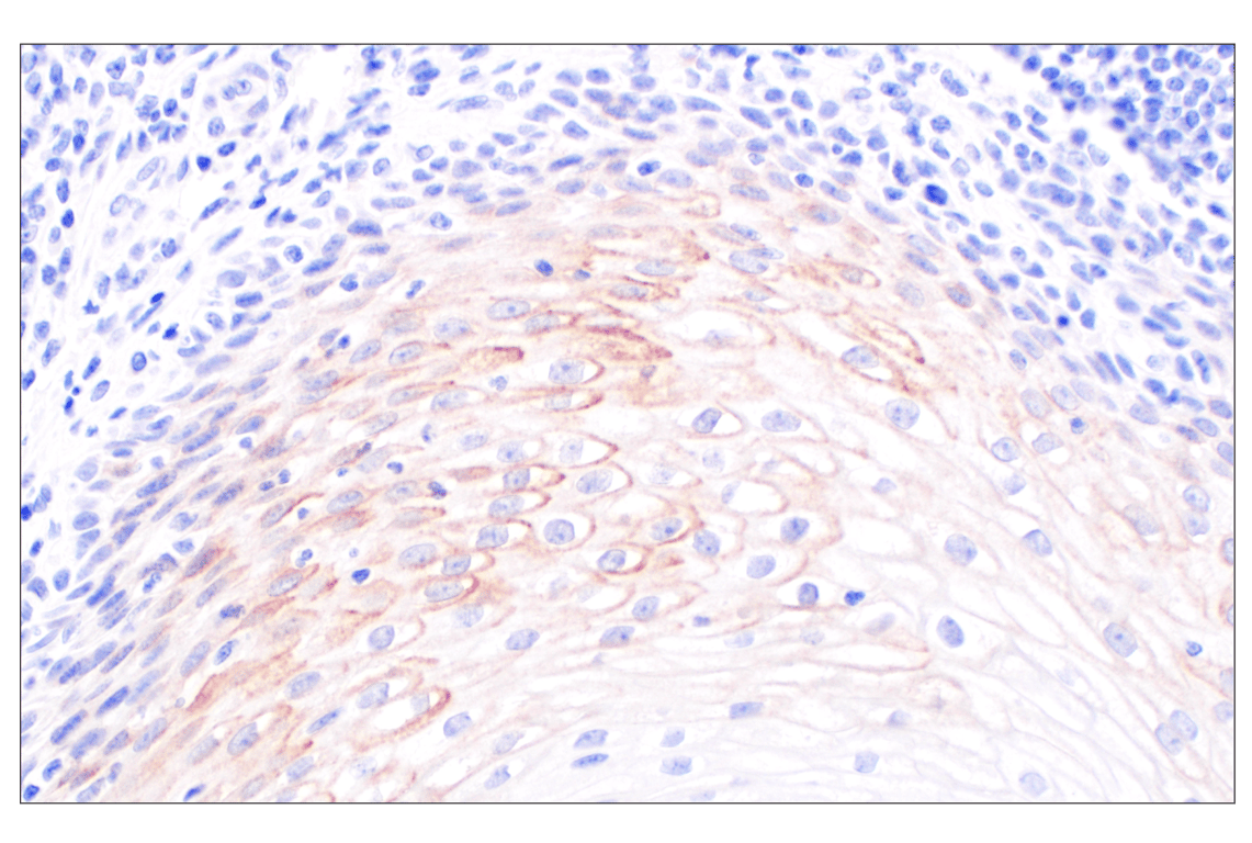 Immunohistochemistry Image 2: IGFBP2 (F3E6V) Rabbit Monoclonal Antibody