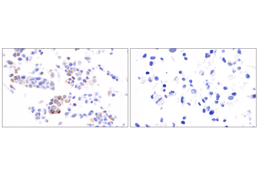 Immunohistochemistry Image 3: AFP (C3) Mouse Monoclonal Antibody
