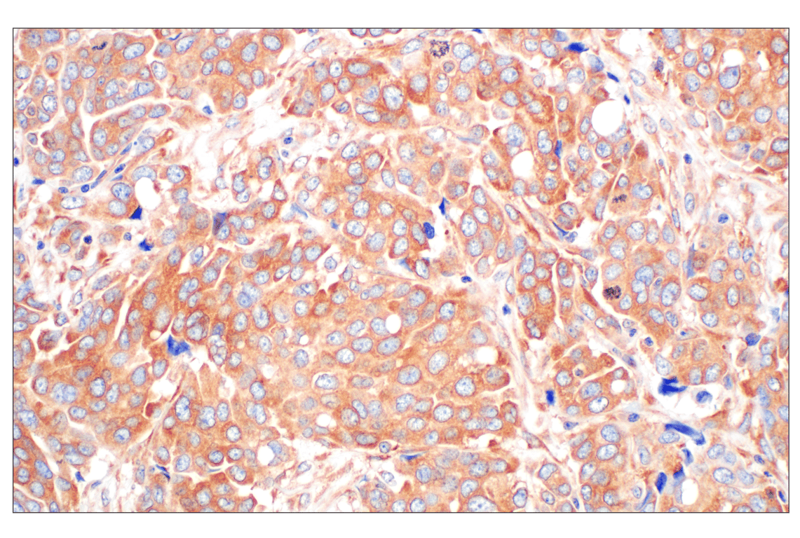 Immunohistochemistry Image 2: EEA1 (E9Q6G) Mouse Monoclonal Antibody