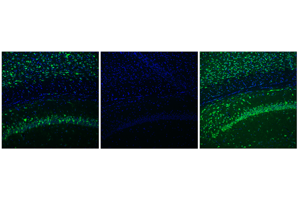 undefined Image 35: Translational Control Antibody Sampler Kit