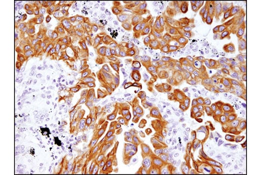 Immunohistochemistry Image 1: MRP4/ABCC4 (D1Z3W) Rabbit Monoclonal Antibody (BSA and Azide Free)