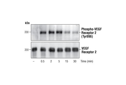 undefined Image 1: Phospho-VEGF Receptor 2 Antibody Sampler Kit