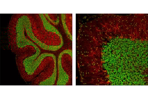 Immunofluorescence Image 1: CREB (D76D11) Rabbit Monoclonal Antibody
