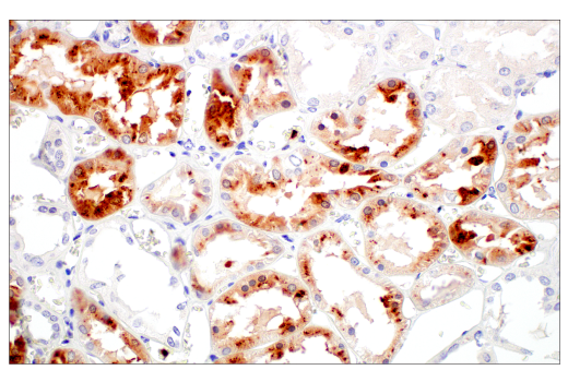 Immunohistochemistry Image 7: LCN2 (D4M8L) Rabbit Monoclonal Antibody