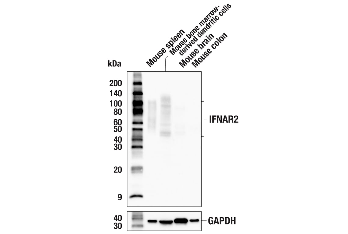 Western Blotting Image 2: IFNAR2 (E7R3A) Rabbit Monoclonal Antibody