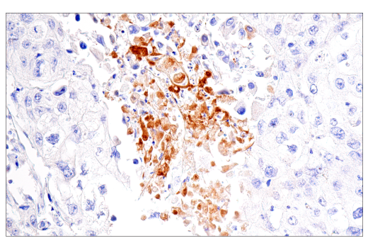 Immunohistochemistry Image 2: Fibrinogen gamma chain (E1U3Z) XP<sup>®</sup> Rabbit mAb (BSA and Azide Free)