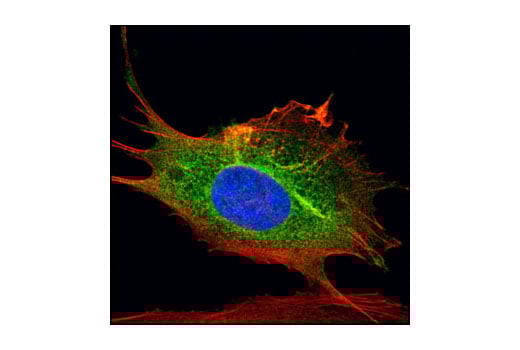 Immunofluorescence Image 1: PKA RI-alpha/beta Antibody