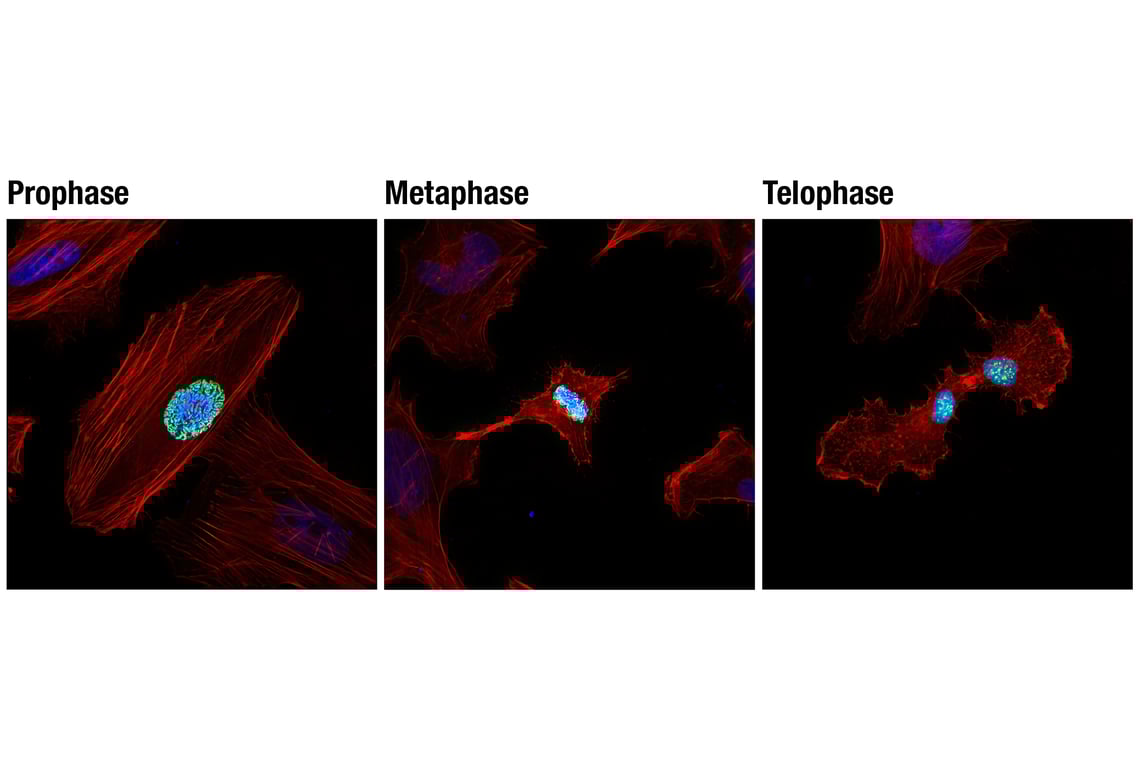 Immunofluorescence Image 1: Phospho-Histone H3 (Ser10) (D7N8E) Rabbit Monoclonal Antibody