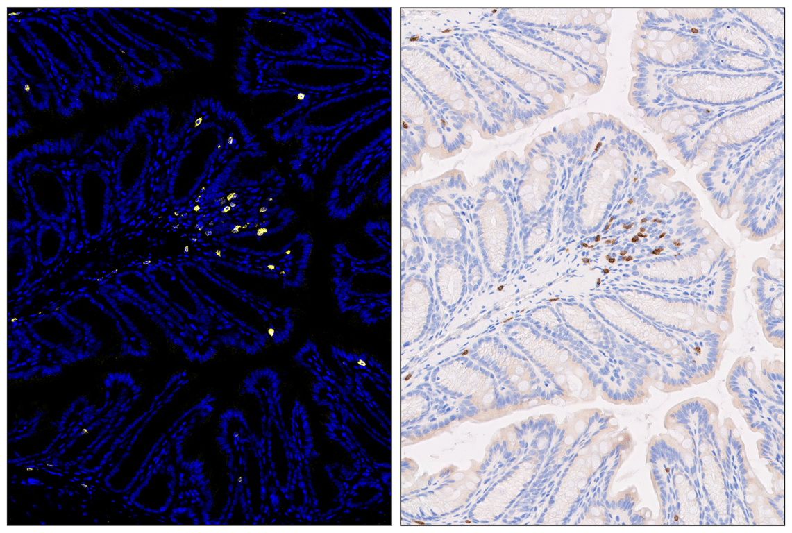 Immunohistochemistry Image 6: CD3 epsilon (E4T1B) & CO-0048-647 SignalStar<sup>™</sup> Oligo-Antibody Pair