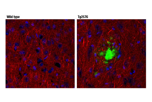 undefined Image 28: Pathological Hallmarks of Alzheimer's Disease Antibody Sampler Kit