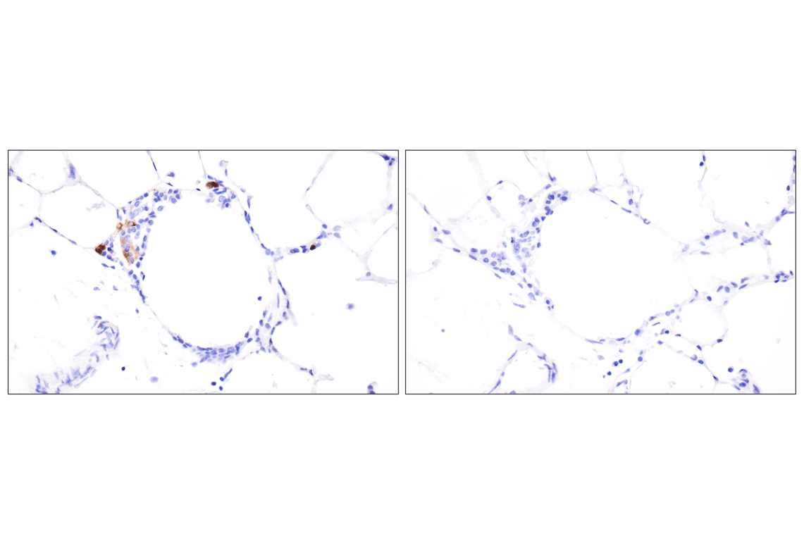 Immunohistochemistry Image 2: Respiratory Syncytial Virus (RSV) Nucleoprotein (N) (F5S9J) Rabbit Monoclonal Antibody