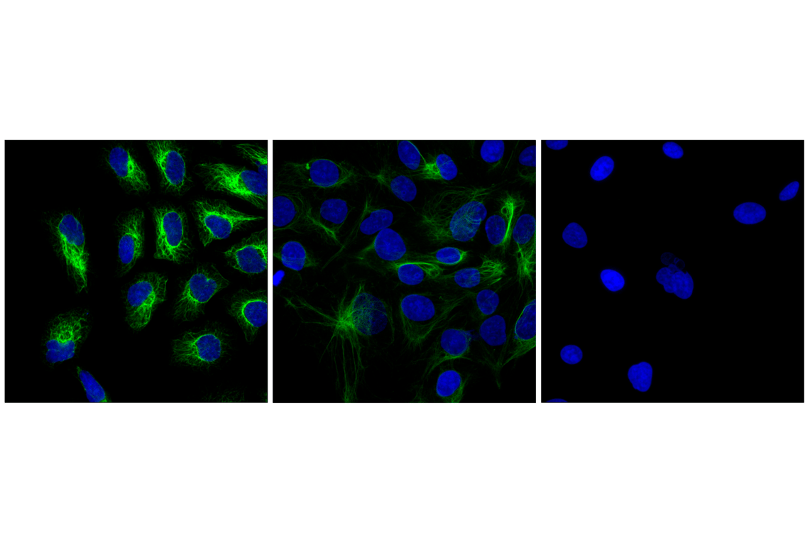 Immunofluorescence Image 1: Keratin 17/19 (D4G2) Rabbit Monoclonal Antibody