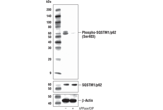 Western Blotting Image 3: Phospho-SQSTM1/p62 (Ser403) (D8D6T) Rabbit Monoclonal Antibody