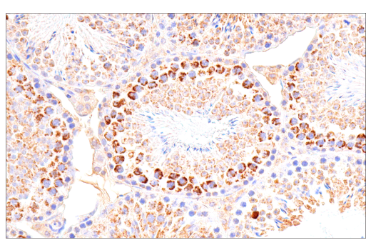 Immunohistochemistry Image 14: SDHB (E3H9Z) Rabbit Monoclonal Antibody