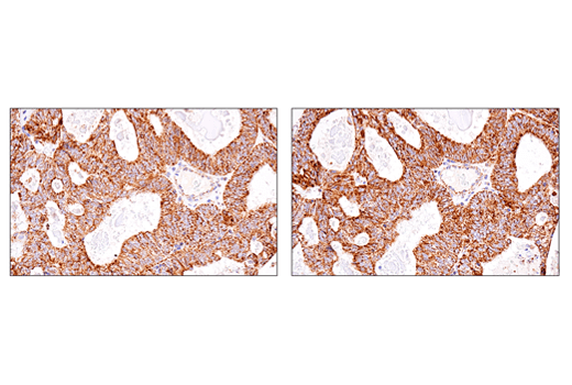 Immunohistochemistry Image 7: SHMT2 (E7F4Q) Rabbit Monoclonal Antibody