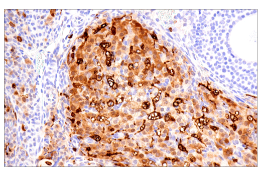Immunohistochemistry Image 9: Galectin-3/LGALS3 (E7B6R) Rabbit Monoclonal Antibody (BSA and Azide Free)