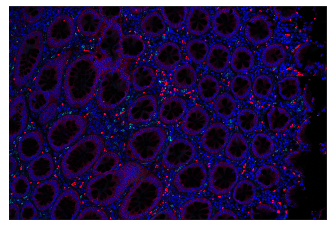 Immunohistochemistry Image 2: Glut1 (E4S6I) & CO-0192-647 SignalStar<sup>®</sup> Oligo-Antibody Pair