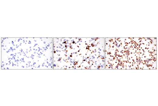 Immunohistochemistry Image 11: SLAMF6/CD352 (E3H1E) Rabbit Monoclonal Antibody