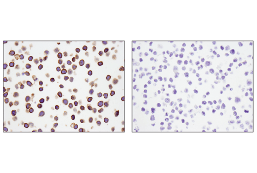 Immunohistochemistry Image 5: CD5 (E8X3S) XP<sup>®</sup> Rabbit mAb