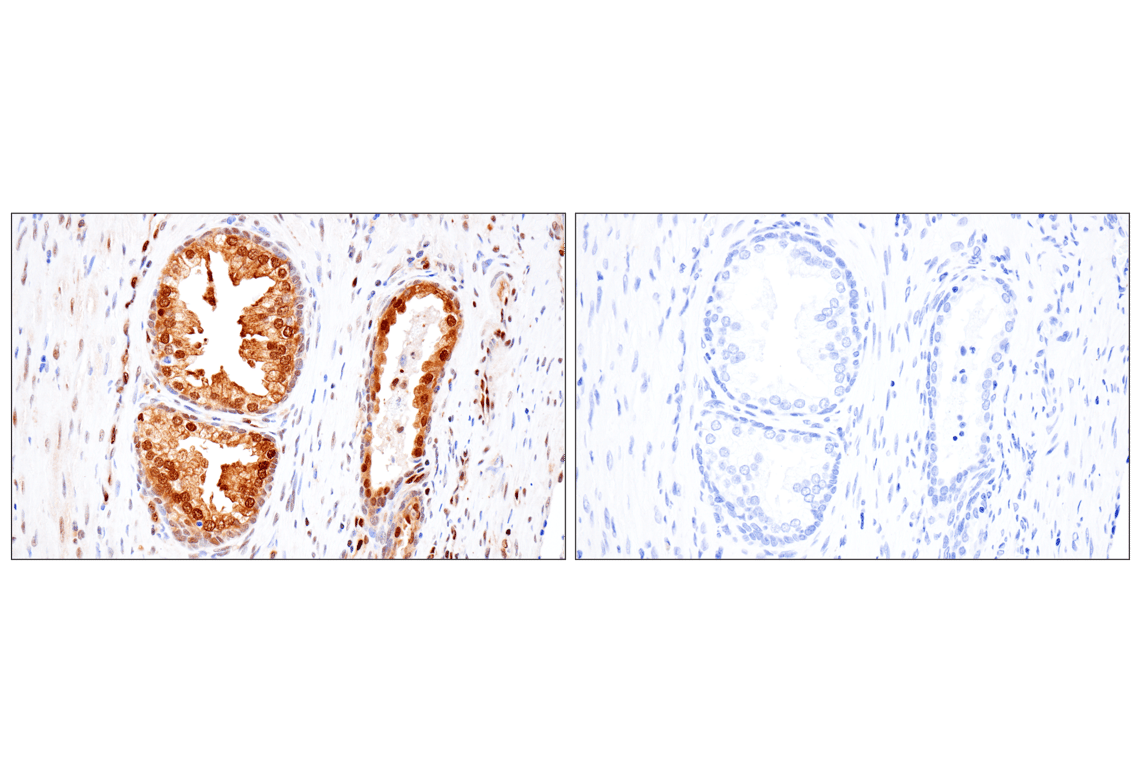 Immunohistochemistry Image 13: Phospho-ATP-Citrate Lyase (Ser455) (F4T8R) Rabbit Monoclonal Antibody