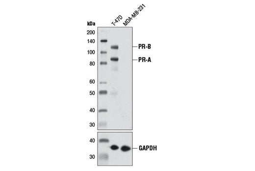 undefined Image 14: Steroid Hormone Receptor Antibody Sampler Kit