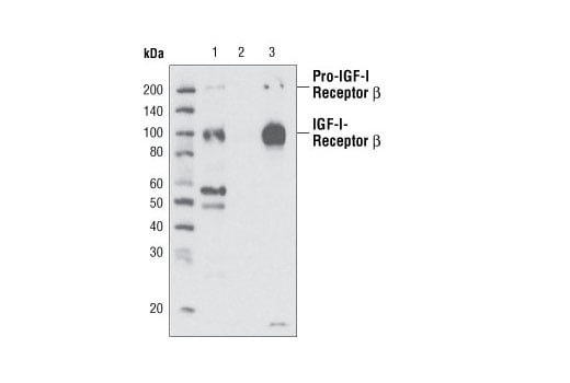 Immunoprecipitation Image 1: IGF-I Receptor beta (111A9) Rabbit Monoclonal Antibody