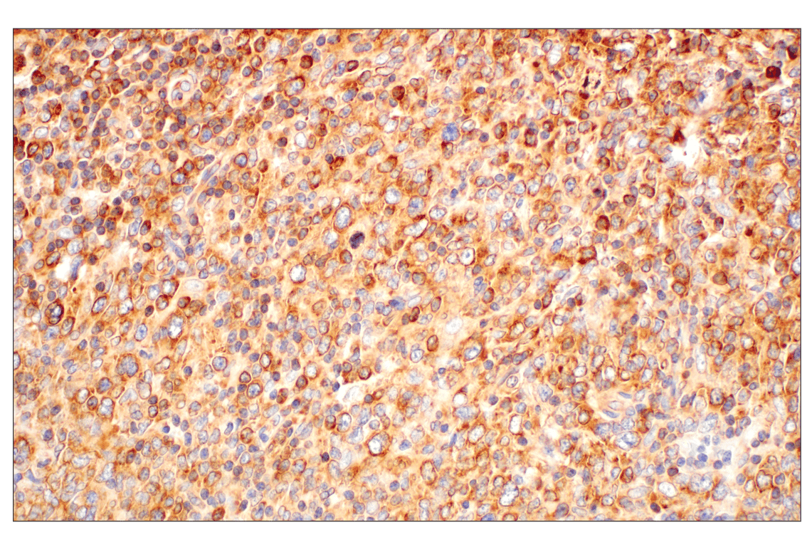Immunohistochemistry Image 3: RACK1 (D59D5) Rabbit Monoclonal Antibody (BSA and Azide Free)