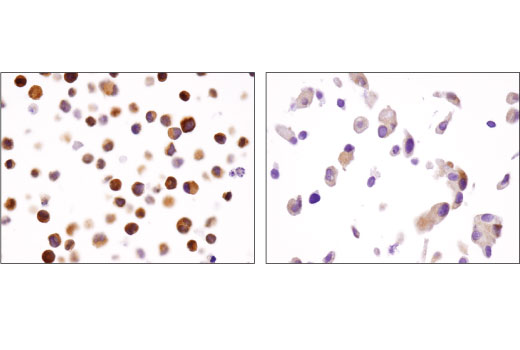 Immunohistochemistry Image 2: HDAC7 (D4E1L) Rabbit Monoclonal Antibody