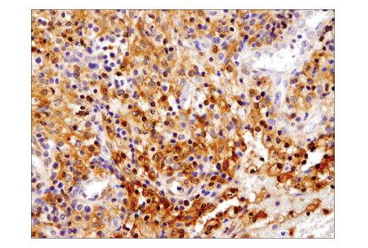 Immunohistochemistry Image 1: Stat1 (D1K9Y) Rabbit Monoclonal Antibody (BSA and Azide Free)