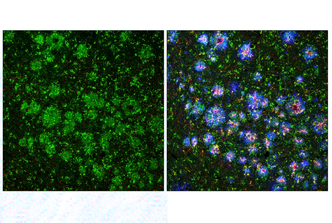 undefined Image 11: Genetics of Parkinson's Disease: Lysosomal Dysfunction Antibody Sampler Kit