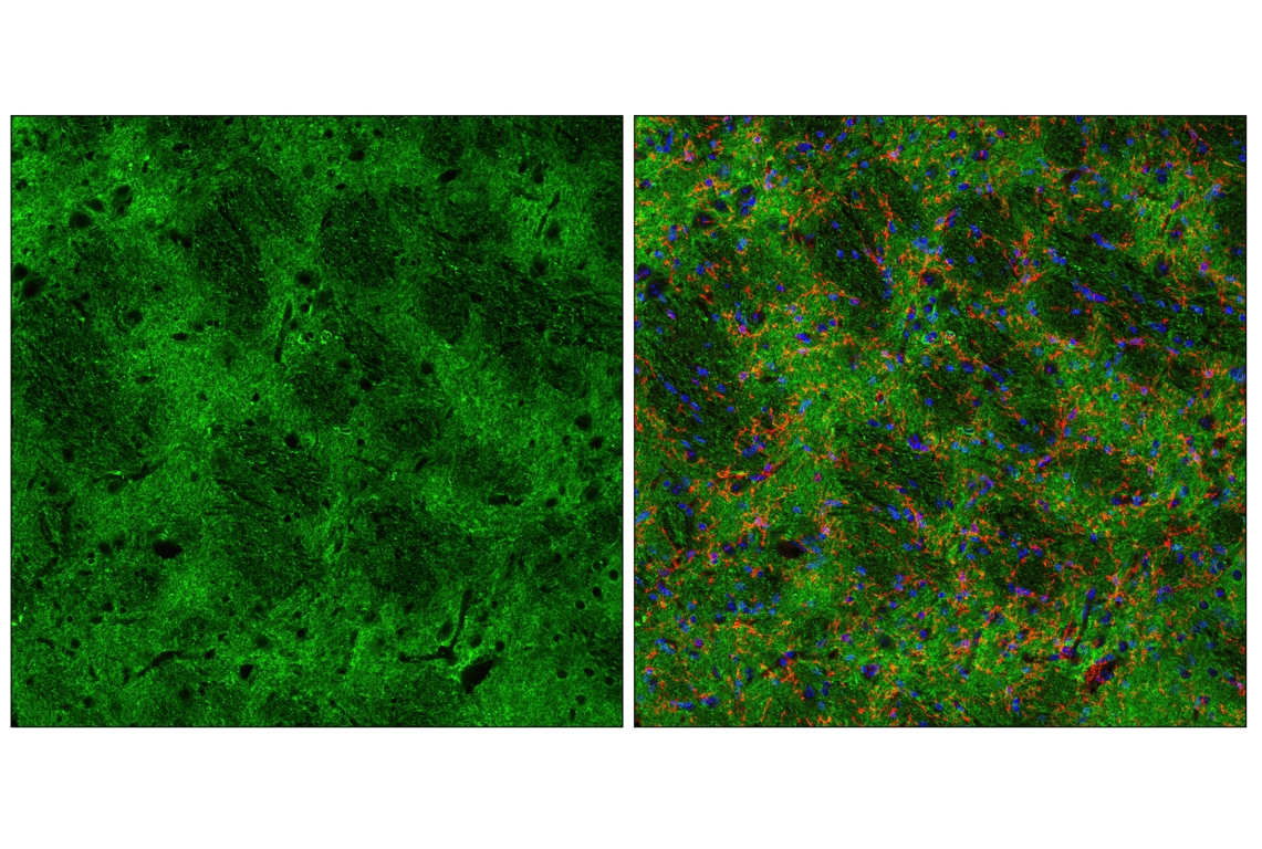 Immunofluorescence Image 3: Tau (D1M9X) XP<sup>®</sup> Rabbit mAb (BSA and Azide Free)