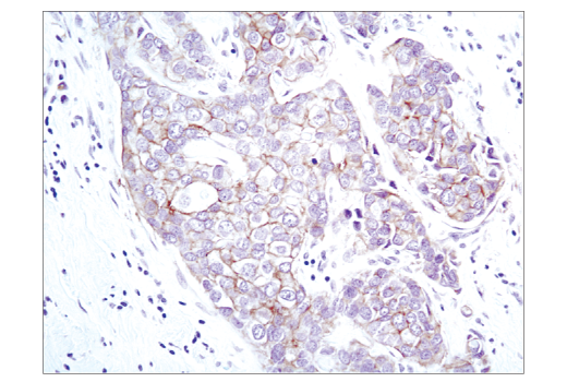 Immunohistochemistry Image 1: EpCAM (VU1D9) Mouse Monoclonal Antibody (BSA and Azide Free)