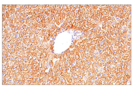 Immunohistochemistry Image 11: SDHB (E3H9Z) Rabbit Monoclonal Antibody
