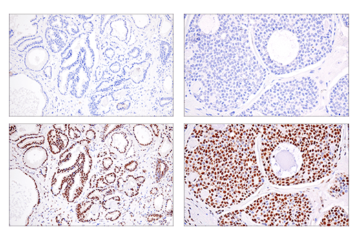 Immunohistochemistry Image 3: SSX (E5A2C) Rabbit Monoclonal Antibody (Carboxy-terminal Antigen)