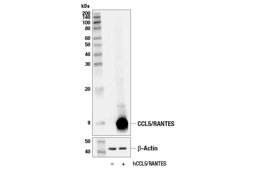 Western Blotting Image 2: CCL5/RANTES (E9S2K) Rabbit Monoclonal Antibody (BSA and Azide Free)