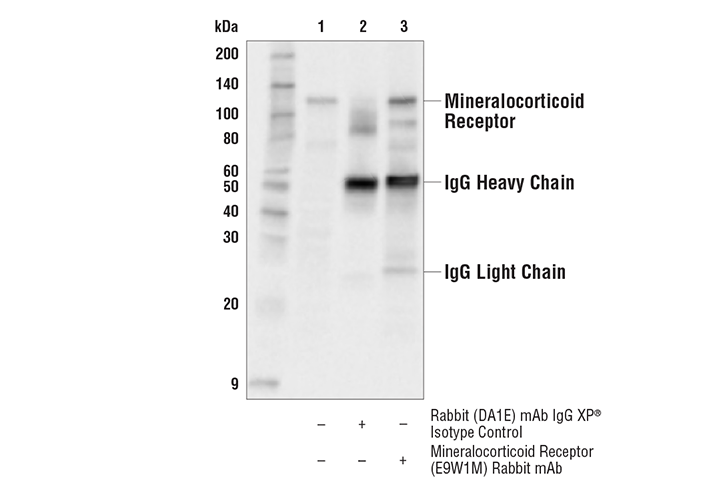 Immunoprecipitation Image 1: Mineralocorticoid Receptor (E9W1M) Rabbit Monoclonal Antibody
