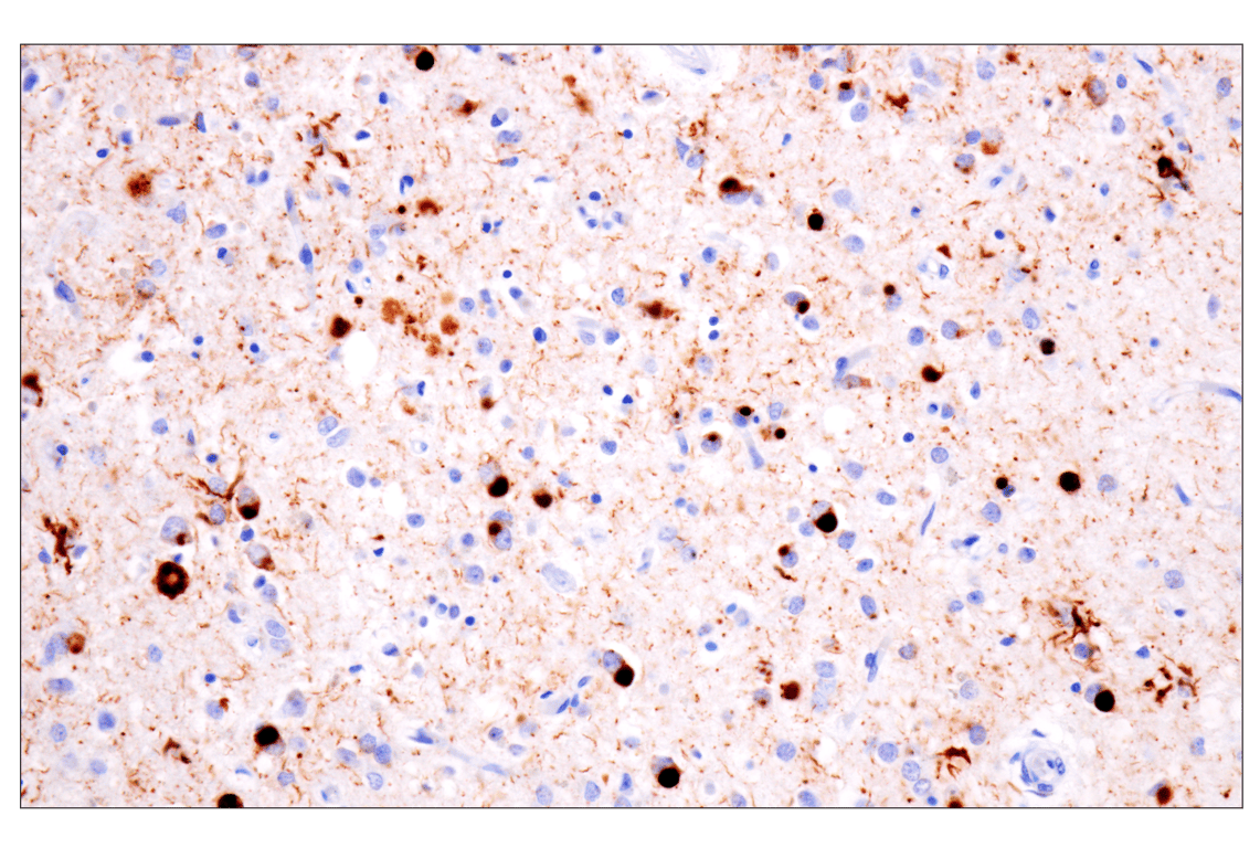 Immunohistochemistry Image 3: Phospho-Tau (Ser396) (F3S9T) Rabbit Monoclonal Antibody