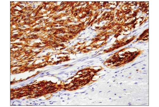 Immunohistochemistry Image 4: c-Kit (D3W6Y) Rabbit Monoclonal Antibody