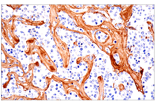 Immunohistochemistry Image 4: COL1A1 (E3E1X) Mouse mAb