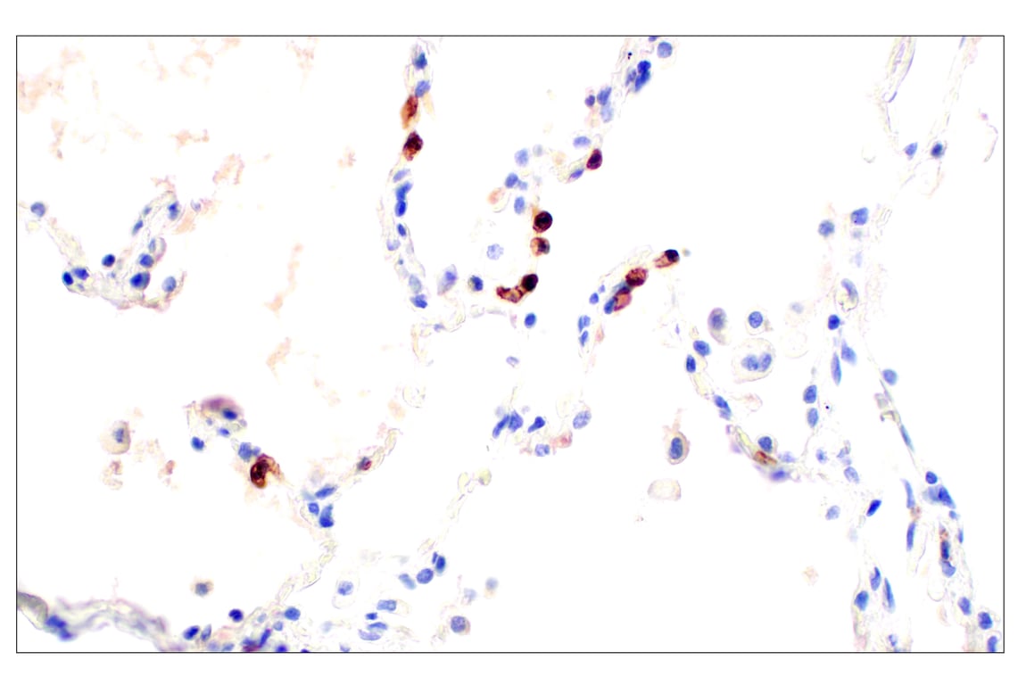 Immunohistochemistry Image 8: CD62L/L-Selectin (E7X9I) Rabbit Monoclonal Antibody (BSA and Azide Free)