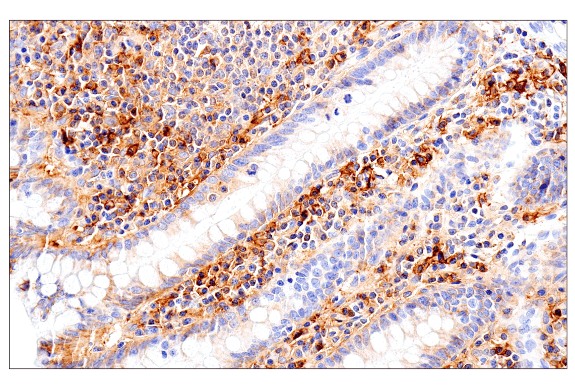 Syndecan 1 (E7F7T) Rabbit mAb | Cell Signaling Technology