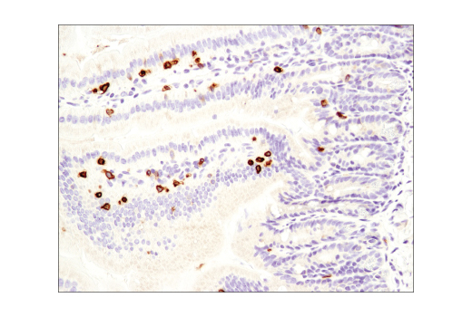 Immunohistochemistry Image 2: CD3 epsilon (D4V8L) Rabbit Monoclonal Antibody (BSA and Azide Free)