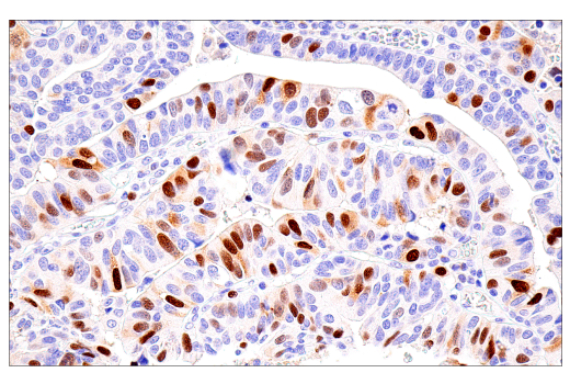 Immunohistochemistry Image 3: Cyclin A2 (E6D1J) XP<sup>®</sup> Rabbit mAb (BSA and Azide Free)