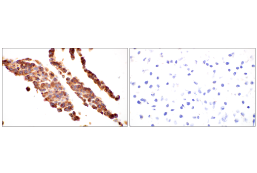 Immunohistochemistry Image 11: ApoE (pan) (E8C2U) Mouse Monoclonal Antibody