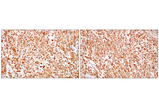 Immunohistochemistry Image 12: Nestin (E4O9E) Rabbit Monoclonal Antibody